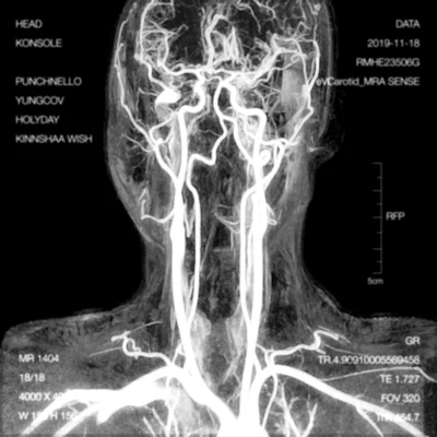 Konsole Head